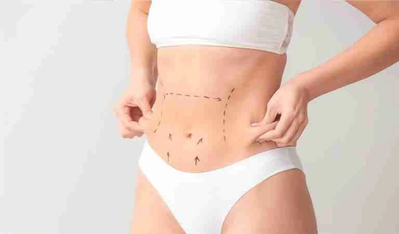 Abdominoplastia – New City Clinic