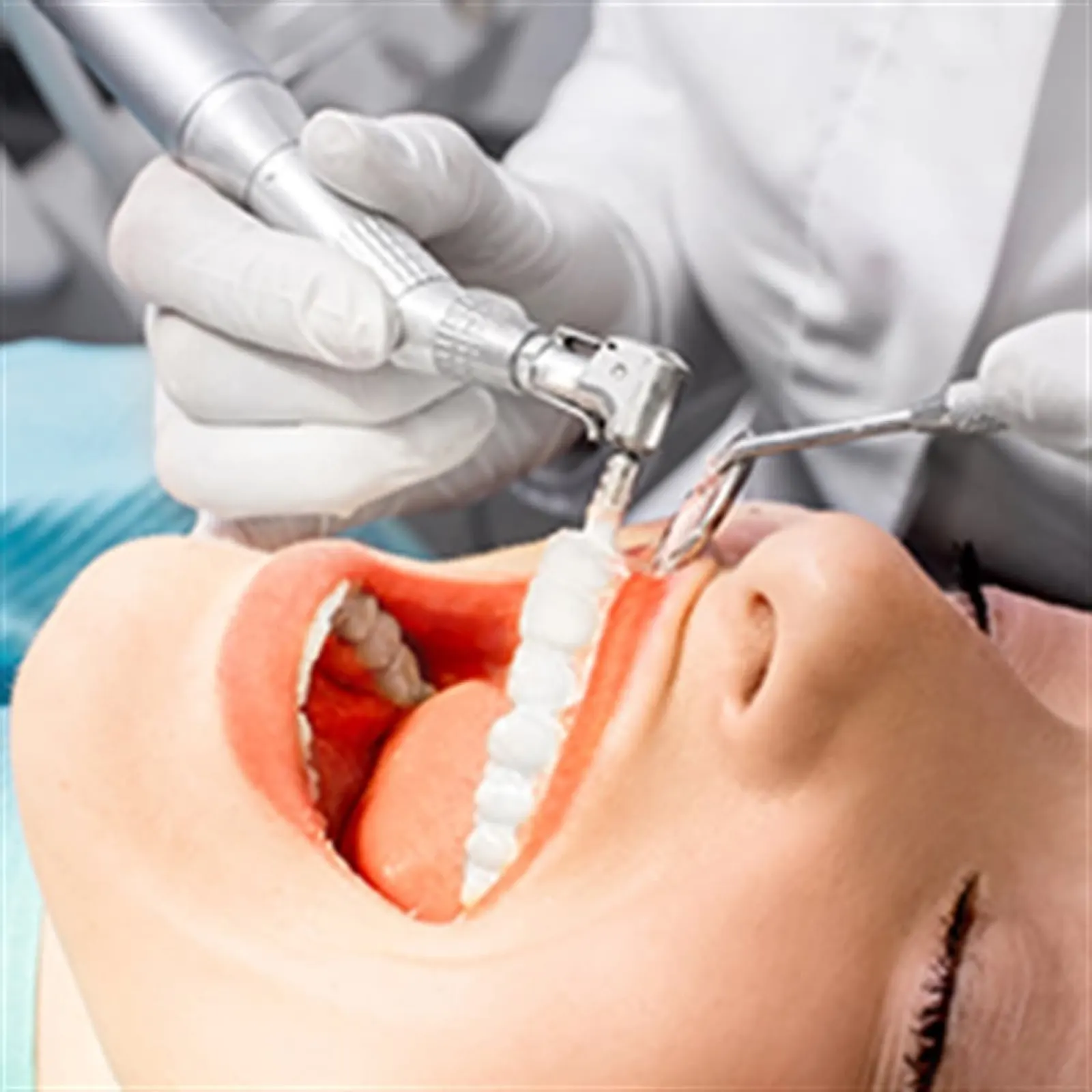 Implantes Dentales en Estambul – New City Clinic