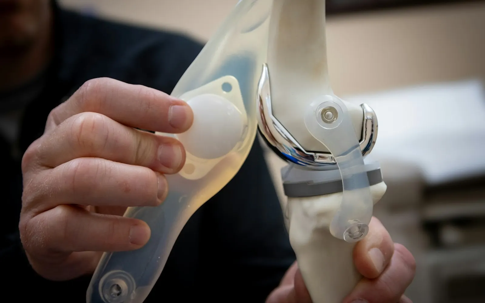 Knee Replacement in Istanbul, Turkey: Cost, Stay and Recovery for UK Patients (2026)