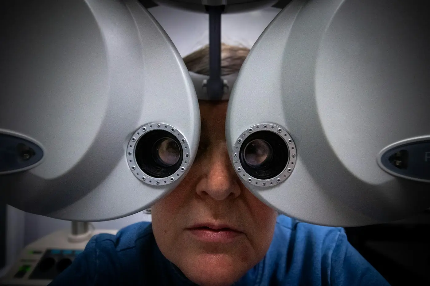 Operacion me lazer i syve (LASIK, SMILE, PRK) – New City Clinic